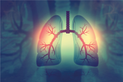 asthma_lungs_xray.jpg