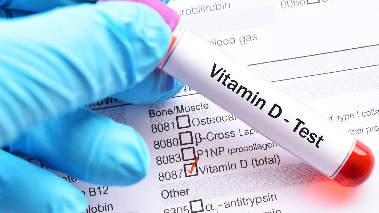 vit-d-test-summary