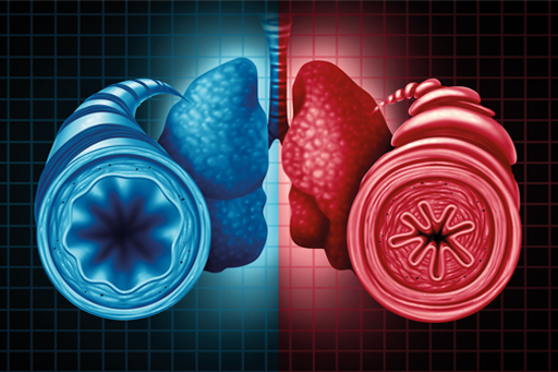 Asthma_COPD_lung_s.jpg